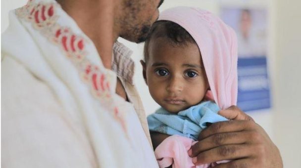 10 Jahre Krieg: Unterernährung bei Kindern im Jemen nimmt wieder zu