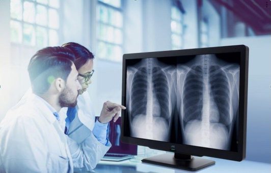 Displays von der Radiologie bis zur Fernbefundung