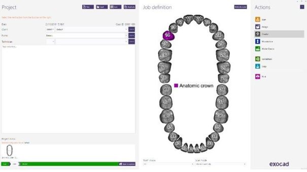 Zusammenarbeit von Coherent und exocad zur Stärkung von Software-Innovationen für die Dentalindustrie