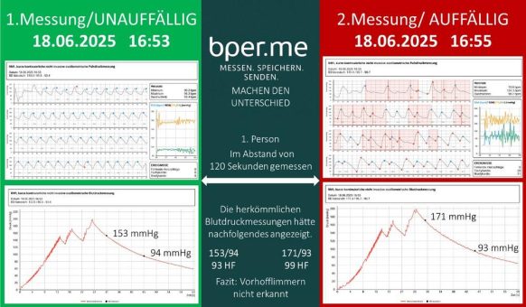 Blutdruckmessung mit System: Warum Vertrauen in die Blutdruckschwankung der erste Schritt ist
