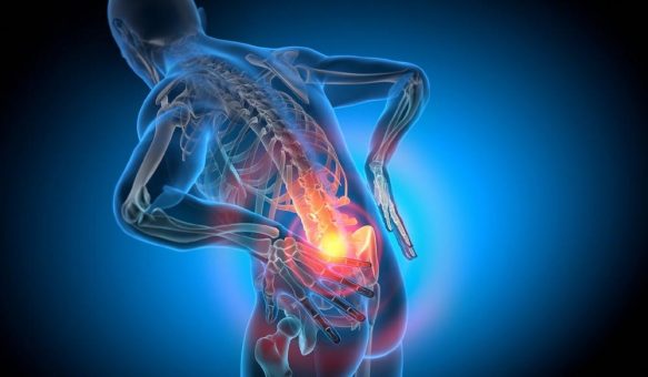 Postdiskektomie-Syndrom – wenn der Rücken nach der OP weiter Schmerzen versursacht