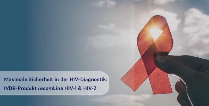 Sicherheit im Laboralltag: Neuer IVDR-zertifizierter recomLine Test für HIV-1 & HIV-2