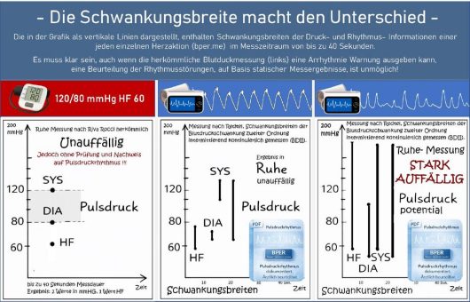 Die Schwankungsbreite macht den Unterschied