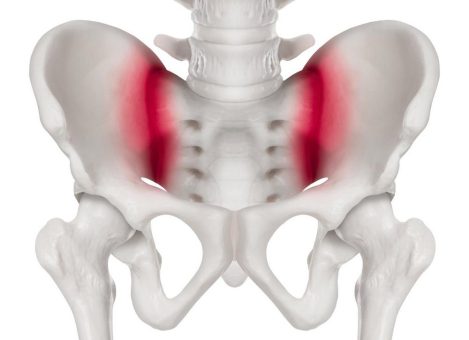 Probleme mit dem Iliosakralgelenk? Das hilft wirklich!