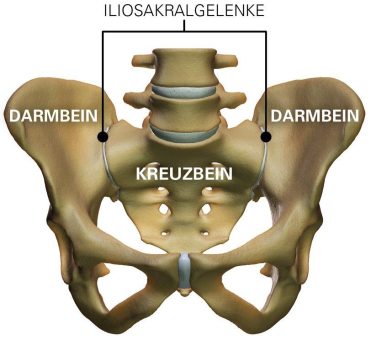 Achtung Verwechslungsgefahr – Ist es ein Bandscheibenvorfall oder das Iliosakralgelenk?