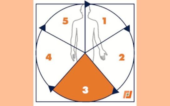 IWiG – Digitalisierung führt nicht zwangsläufig zu guten Prozessen