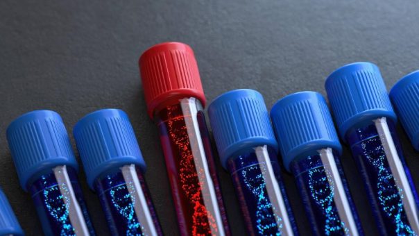 Neue Chancen auf Heilung bei seltenen Blutkrankheiten