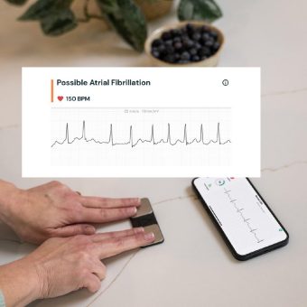 Gesundheitsdaten erfassen: Herzrhythmus eigenständig beobachten mit AliveCor