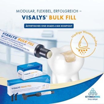 Das neue Füllungskomposit VISALYS® Bulk Fill – für langlebige Restaurationen mit System